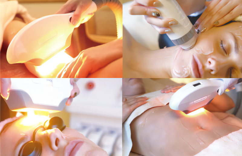 脱毛機搭載の4種類のヘッド